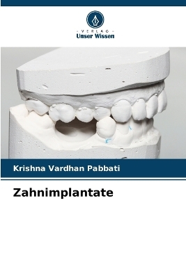 Zahnimplantate - Krishna Vardhan Pabbati