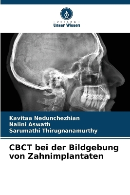 CBCT bei der Bildgebung von Zahnimplantaten
