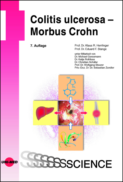 Colitis ulcerosa - Morbus Crohn - Klaus R. Herrlinger, Eduard F. Stange