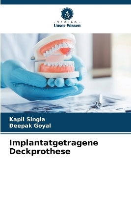 Implantatgetragene Deckprothese - Kapil Singla, Deepak Goyal