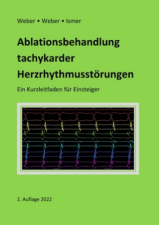 Ablationsbehandlung tachykarder Herzrhythmusstörungen