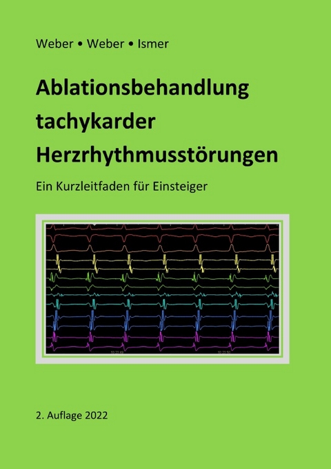 Ablationsbehandlung tachykarder Herzrhythmusst&ouml;rungen - Frank Weber