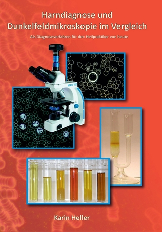 Harndiagnose und Dunkelfeldmikroskopie im Vergleich