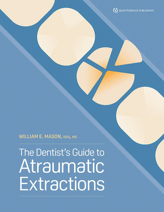 The Dentist's Guide to Atraumatic Extraction