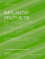 Implantatprothetik 2 Bände - Wolfart, Stefan; Stawarczyk, Bogna