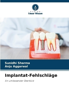 Implantat-Fehlschl&auml;ge - Sunidhi Sharma, Anju Aggarwal