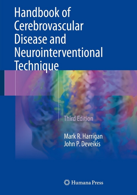 Handbook of Cerebrovascular Disease and Neurointerventional Technique -  Mark R. Harrigan,  John P. Deveikis