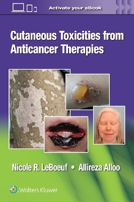 Cutaneous Toxicities from Anticancer Therapies - Dr. Nicole LeBoeuf, Dr. Allireza Alloo