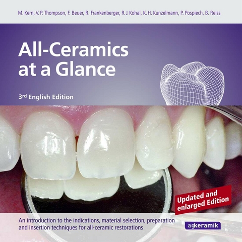 All-Ceramics at a Glance. updated enlarged 3rd English Edition - Matthias Kern, Van P. Thompson, Florian Beuer, Daniel Edelhoff, Roland Frankenberger, Ralf-Joachim Kohal, Karl-Heinz Kunzelmann, Peter Pospiech, Bernd Reiss