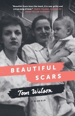 Beautiful Scars - Tom Wilson