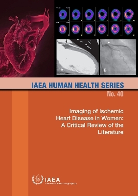 Imaging of Ischemic Heart Disease in Women