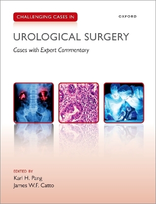 Challenging Cases in Urological Surgery - 