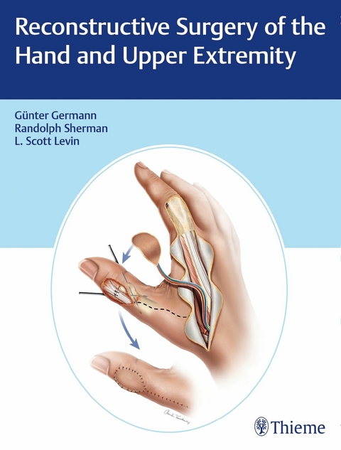 Reconstructive Surgery of the Hand and Upper Extremity -  G&uuml;nter Germann,  L. Scott Levin,  Randolph Sherman