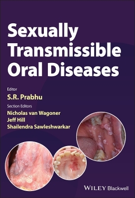 Sexually Transmissible Oral Diseases - 