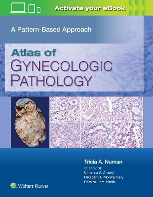 Atlas of Gynecologic Pathology - Tricia A. Numan