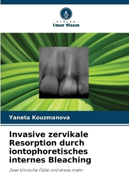 Invasive zervikale Resorption durch iontophoretisches internes Bleaching