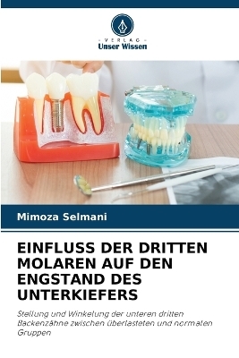Einfluss Der Dritten Molaren Auf Den Engstand Des Unterkiefers