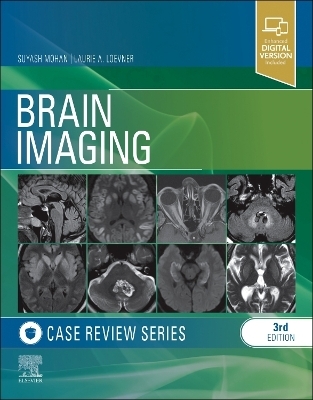 Brain Imaging - Suyash Mohan, Laurie A. Loevner