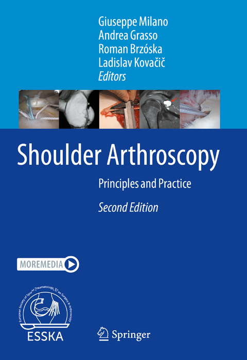 Shoulder Arthroscopy - 