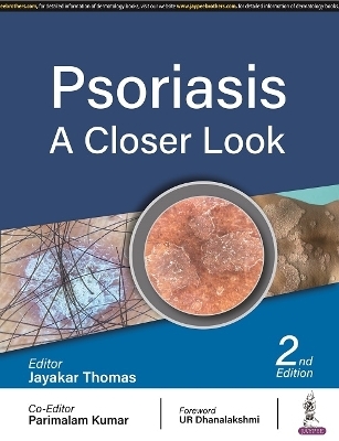 Psoriasis