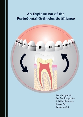 An Exploration of the Periodontal-Orthodontic Alliance - Girish Suragimath, Kirti Anil Shetgaonkar, A. Siddhartha Varma