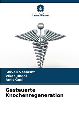 Gesteuerte Knochenregeneration - Shivali Vashisht, Vikas Jindal, Amit Goel