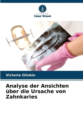 Analyse der Ansichten über die Ursache von Zahnkaries