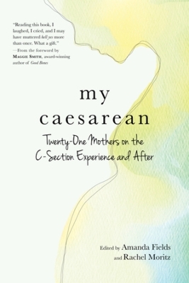 My Caesarean - 