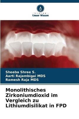 Monolithisches Zirkoniumdioxid im Vergleich zu Lithiumdisilikat in FPD
