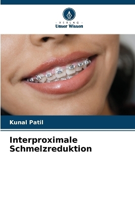 Interproximale Schmelzreduktion
