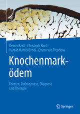 Knochenmark&ouml;dem - Reiner Bartl, Christoph Bartl, Harald Marcel Bon&eacute;l, Emmo Von Tresckow