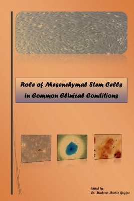 Role of Mesenchymal Stem Cells in Common Clinical Conditions - Mudasir Bashir