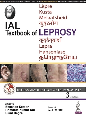 IAL Textbook of Leprosy - Bhushan Kumar, Hemanta Kumar Kar, Sunil Dogra
