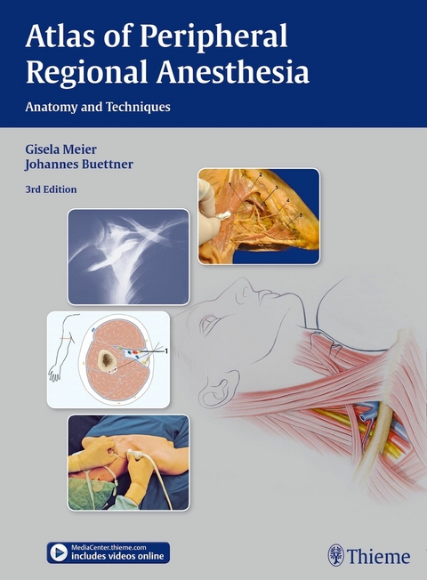 Atlas of Peripheral Regional Anesthesia -  Gisela Meier,  Johannes Buettner