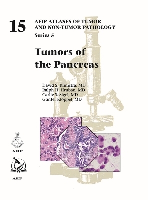 Tumors of the Pancreas