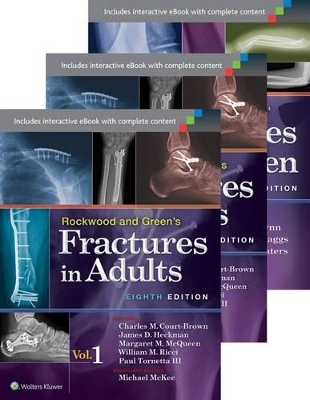 Rockwood, Green, and Wilkins' Fractures in Adults and Children Package - III Tornetta  Paul, Charles Court-Brown, James D. Heckman, Michael McKee, Margaret M. McQueen