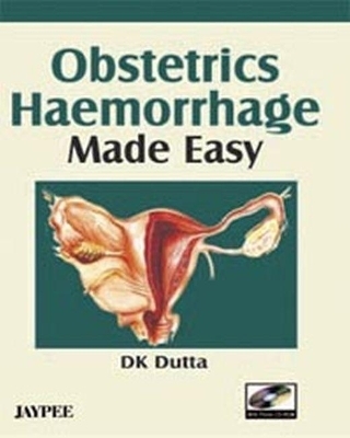 Obstetrics Haemorrhage Made Easy - D. K. Dutta