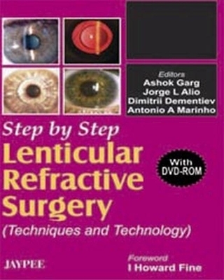 Step by Step Lenticular Refractive Surgery