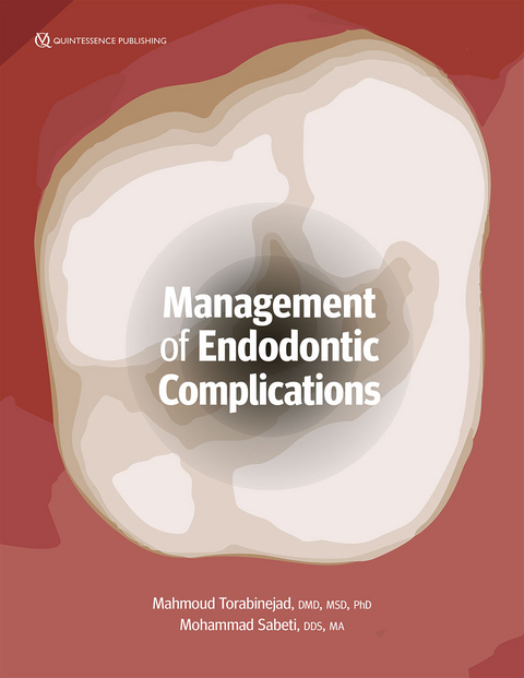 Management of Endodontic Complications - 