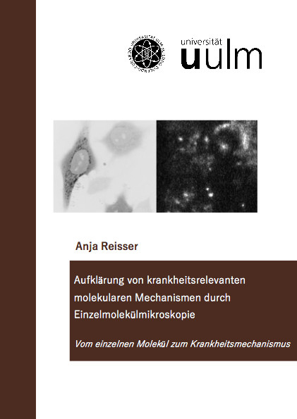 Aufkl&auml;rung von krankheitsrelevanten molekularen Mechanismen durch Einzelmolek&uuml;lmikroskopie - Anja Reisser