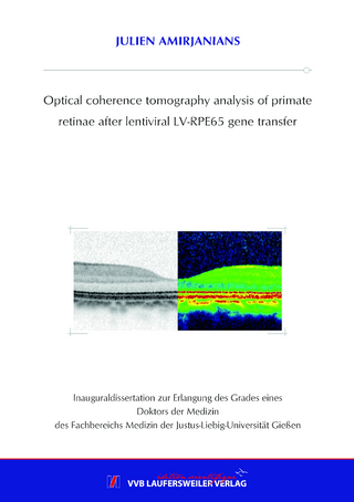 Optical coherence tomography analysis of primate retinae after lentiviral LV-RPE65 gene transfer