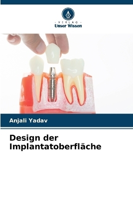 Design der Implantatoberfl&auml;che - Anjali Yadav