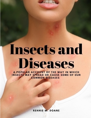 Insects and Diseases - A Popular Account of the Way in Which Insects may Spread or Cause some of our Common Diseases -  Rennie W Doane