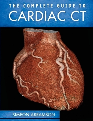 The Complete Guide to Cardiac CT