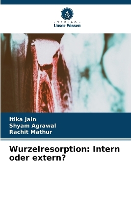 Wurzelresorption - Itika Jain, Shyam Agrawal, Rachit Mathur