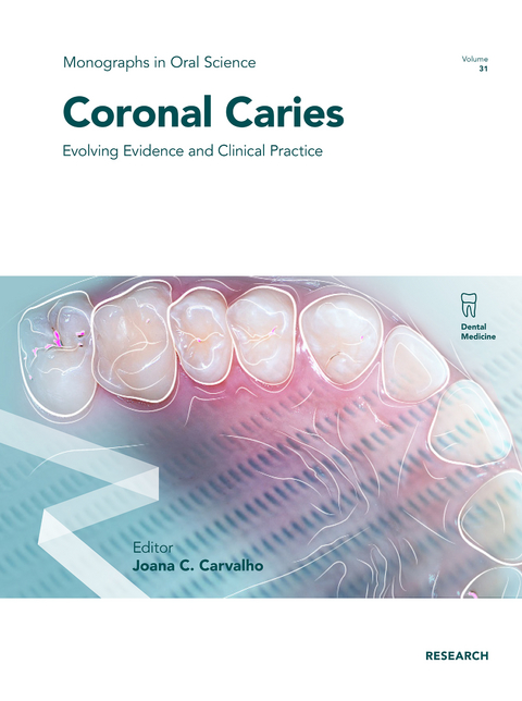 Coronal Caries - 