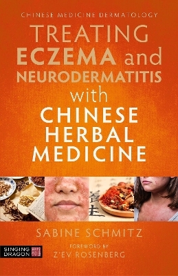 Treating Eczema and Neurodermatitis with Chinese Herbal Medicine - Sabine Schmitz