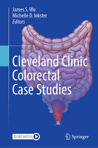 Cleveland Clinic Colorectal Case Studies