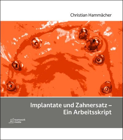 Implantate und Zahnersatz - Ein Arbeitsskript - Dr. Christian Hamm&auml;cher
