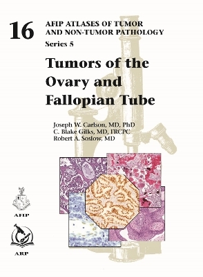 Tumors of the Ovary and Fallopian Tube - Joseph W. Carlson, C. Blake Gilks, Robert A. Soslow